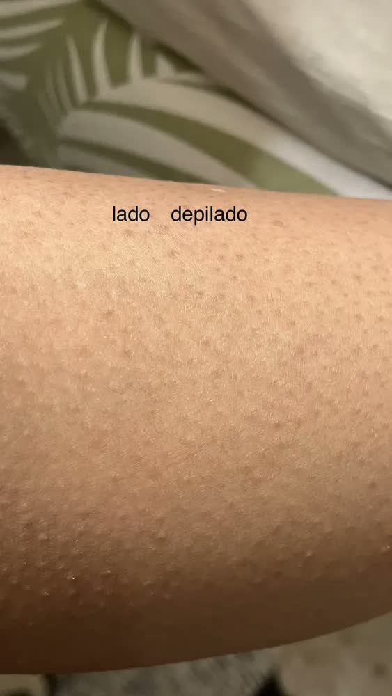 foto de Depilador Philco Aqua Deluxe Plus Pdp02r Cor Branco/Rosa