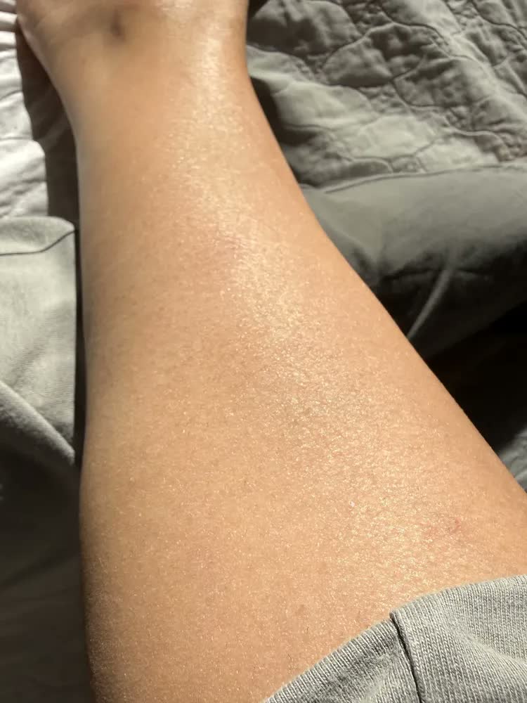 foto de Depilador A Laser De Depilador Luz Pulsada IPL Profissional 9 Níveis De Ajuste, Sensacao Gelo Indolor Depilacao Definitiva, Unissex Para Bivolt Depilacao Laser Dep Portatil, Para Corpo Todo Basike