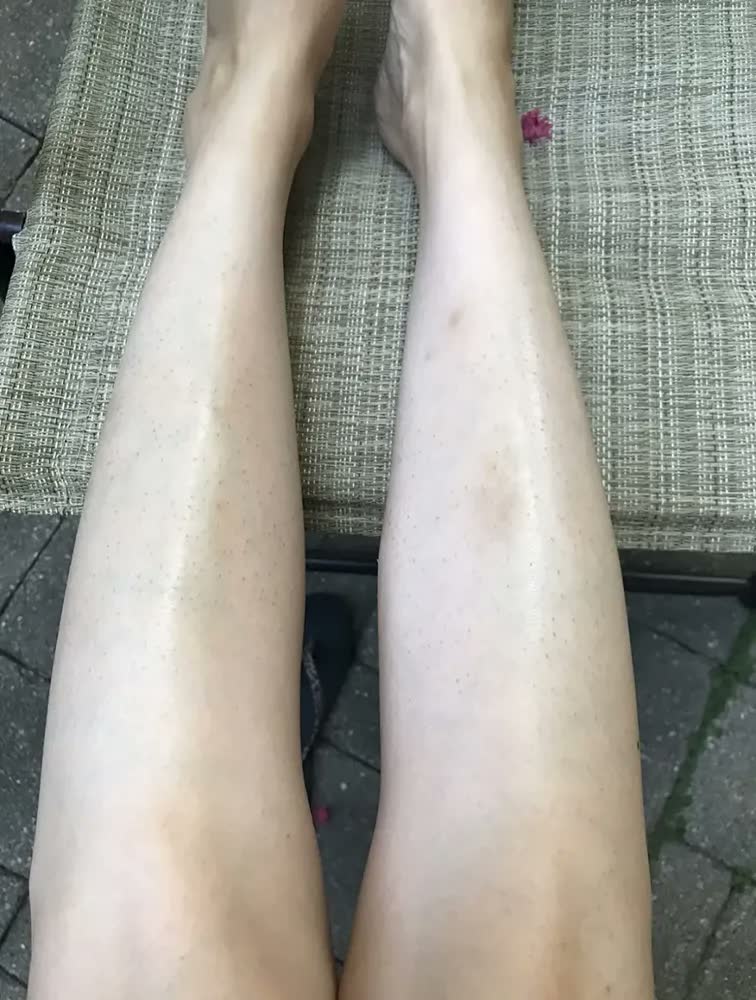 foto de Aparelho Depilação Laser Ipl Portátil Mlay T11 Profissional