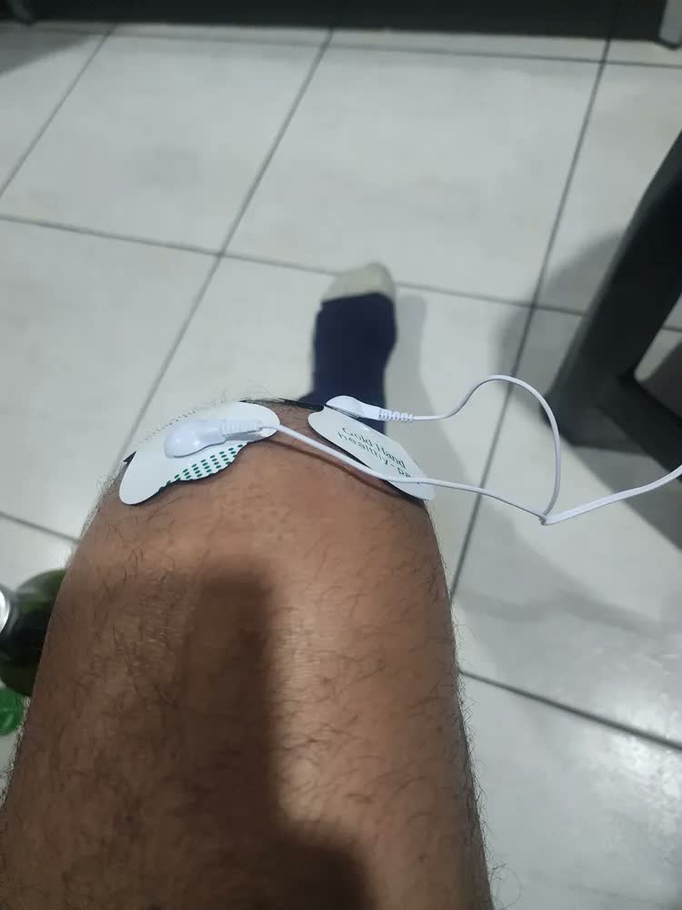 foto de Aparelho De Fisioterapia Choque Elétrico Acupuntura